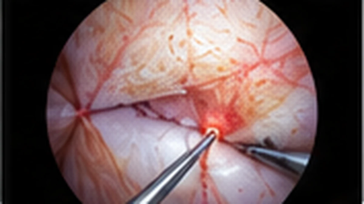 Illustration of the camera-guided, small-access concept used in endoscopic spine surgery.