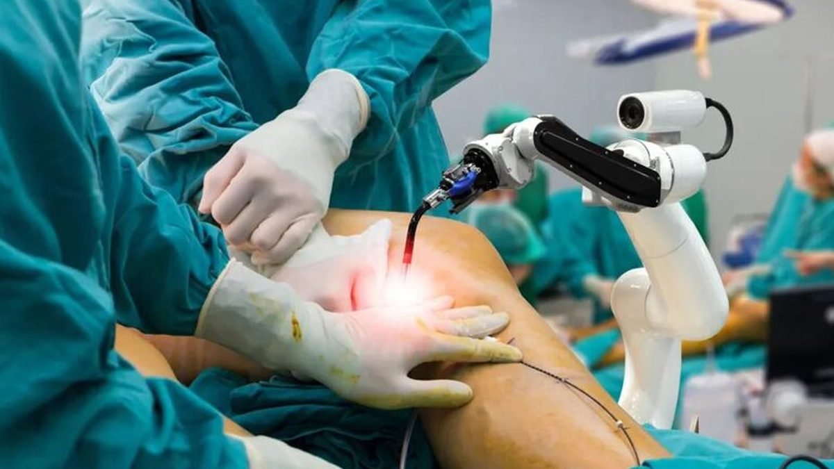 Illustration of a robotic-arm assisted knee replacement setup in an operating theatre, showing the surgeon guiding a robotic arm during implant positioning