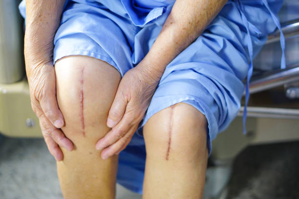 joint replacement specialist in kharghar